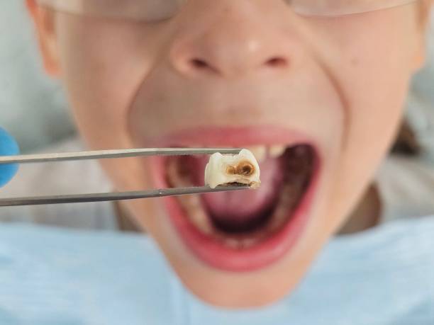 Emergency Dentist for Kids in AL